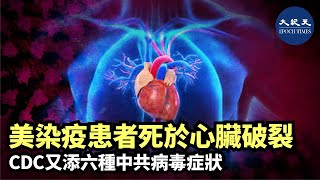 【焦點速遞】(字幕）最新研究指年輕患者會因中共病毒導致突然中風而猝死；法國中共病毒重症監護室致死率約為30%～40%；美CDC報告增添六種中共病毒症狀。| #香港大紀元新唐人聯合新聞頻道