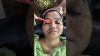 HIGH FREQUENCY TREATMENT ( #skintightening  , #skinwhitening  #pigmentation &  #pigmentationfacial )