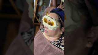 Ayurveda Treatment for Eyes 👁 NETRA TARPANA