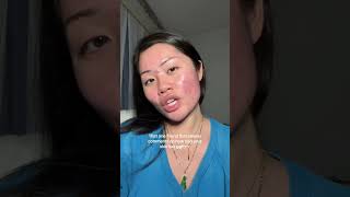 Like I know 😭 #acne #skincare #acneskincare #acnepositivity #skinconfidence