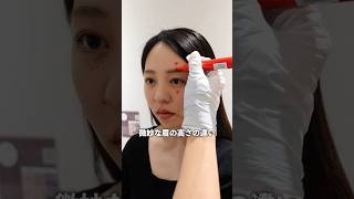 【前編】大本命「サーマジェン」レポ#サーマジェン#ハイフ#美容医療#たるみ治療#シワ改善#HIFU#美容クリニック#アラサー#30代#エイジング#エイジングケア