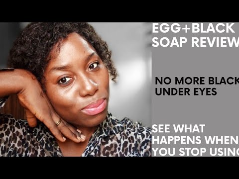 Eggsoap Review/ Results in five days will shock you😲. Diy Skin repair/anti-aging face Soap. #eggsoap