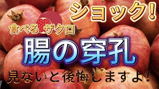 ショック！ ザクロを食べると腸穿孔を引き起こす可能性があります。 見ないと後悔しますよ！