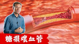 糖尿病7.糖對血管的影響, 血管堵塞,血管硬化,糖尿病併發症.抗氧化食物很重要!! 柏格醫生Dr Berg