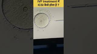 ICSI Procedure in IVF, Intracytoplasmic sperm injection #fertilitytreatment #ivfjourney #ivfsuccess
