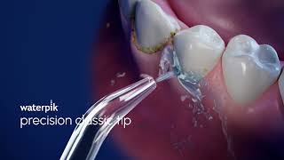Waterpik™ Precision Tip