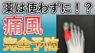 【痛風 予防】薬に頼らず尿酸値を劇的に下げる方法