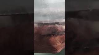 Human Anatomy Cadaver Dissection – Upper Limb #cadaverdissection  #medicaleducation #physiotherapy