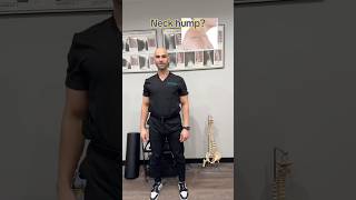 Neck hump? Try this and share! #neckhump #shorts #tips #viral