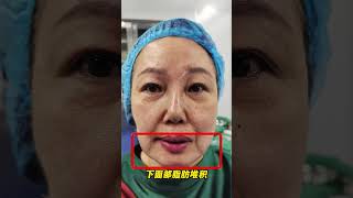 素人改造！阿姨变上镜脸！