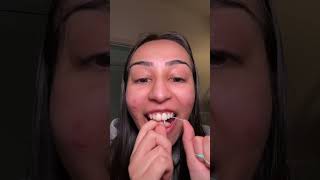 #dentalcare #oralcaretips #oralcareproducts #oralcareroutine #dentalhygiene