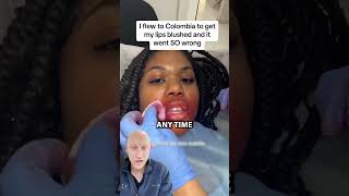 Lip Blushing GONE WRONG? | Plastic Surgeon Reacts