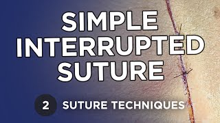 Simple Interrupted Suture - Learn Suture Techniques