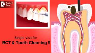 Can one plan oral prophylaxis and RCT opening in single visit? - Dr. Chandan Mahesh