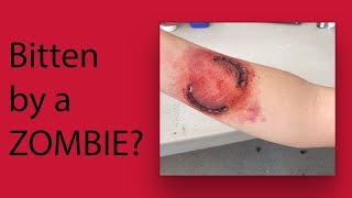 ZOMBIE ATTACK! Prosthetic Makeup Application