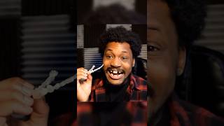 WHERE Did His Teeth Go?! 👀🦷