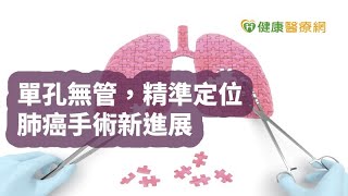 【記者會速報】台大創單孔無管手術　肺癌患者新福音｜健康醫療網