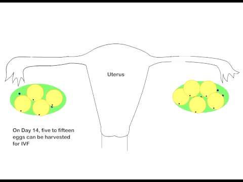 Controlled Ovarian hyperstimulation