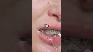 TOP 10 Hacks for Sparkling White Teeth at Home! #teethwhitening #pearlywhites #whiteteeths